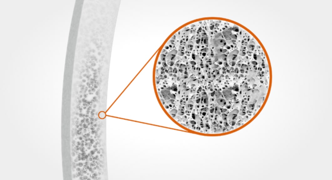 close-up view of the microscopic structure of allogeneic tissue used in AlloFlo